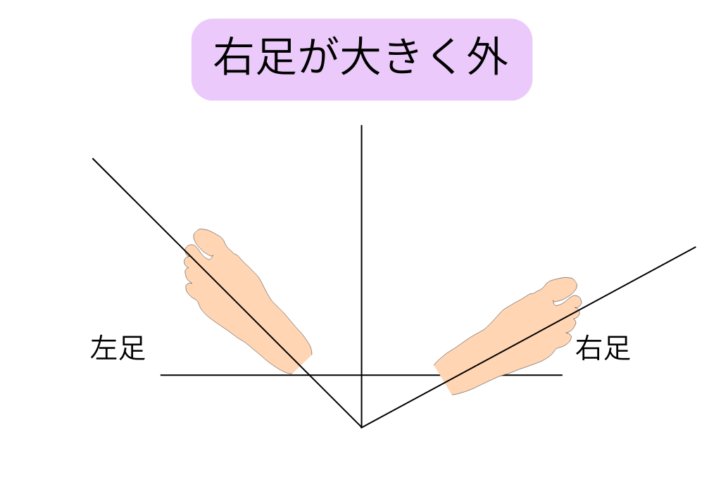 右足が大きく外