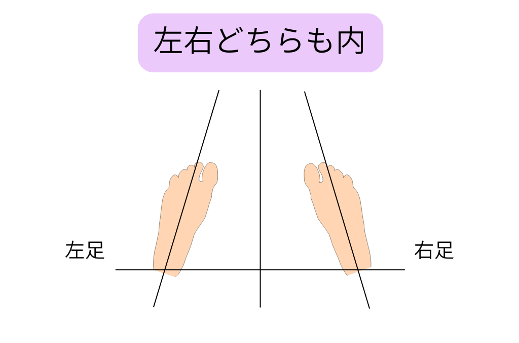 左右どちらも内